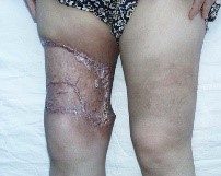 法轮功学员刘爱琴 法轮功学员刘爱琴